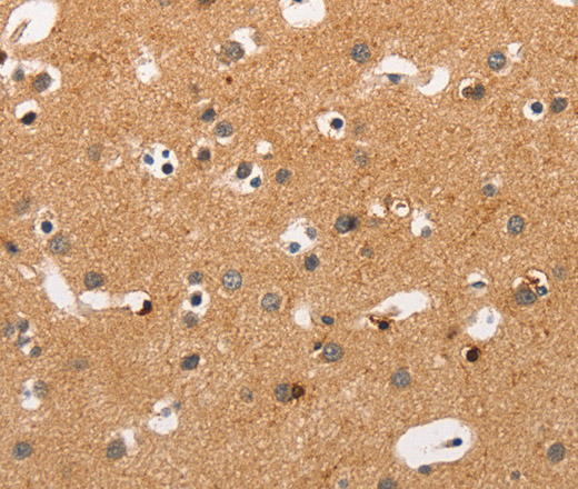 Immunohistochemistry of paraffin-embedded Human brain tissue using Crystallin-alpha C Polyclonal Antibody at dilution 1:45