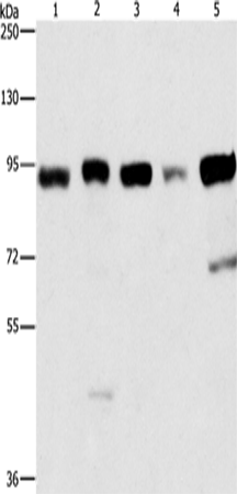 Western Blot analysis of Raji and 231 cell, hepG2、hela and 293T cell using IMMT Polyclonal Antibody at dilution of 1:270