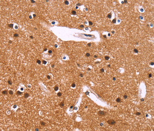 Immunohistochemistry of paraffin-embedded Human brain  using IRAK1BP1 Polyclonal Antibody at dilution of 1:40