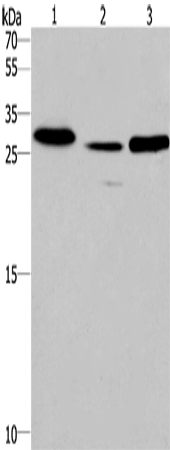 Western Blot analysis of Human fetal liver tissue and Mouse heart tissue,Human testis tissue using IRAK1BP1 Polyclonal Antibody at dilution of 1:475
