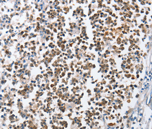 Immunohistochemistry of paraffin-embedded Human tonsil using MCM6 Polyclonal Antibody at dilution of 1:45