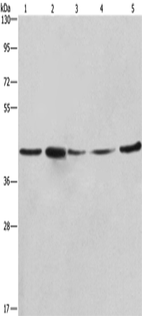 Western Blot analysis of A549, NIH/3T3 and 293T cell，Human hepatocellular carcinoma tissue and hela cell using RPSA Polyclonal Antibody at dilution of 1:425