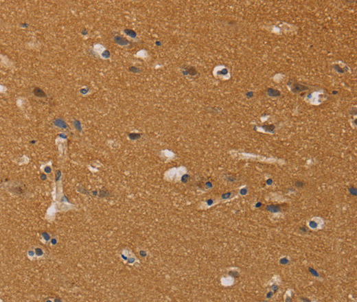 Immunohistochemistry of paraffin-embedded Human brain tissue using CHRNA4 Polyclonal Antibody at dilution 1:40