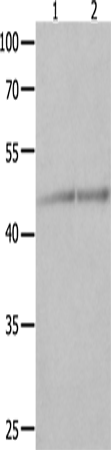 Western Blot analysis of Jurkat and K562 cell  using NCK1 Polyclonal Antibody at dilution of 1:600