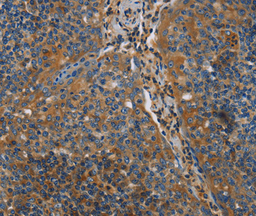 Immunohistochemistry of paraffin-embedded Human tonsil using NRN1 Polyclonal Antibody at dilution of 1:40