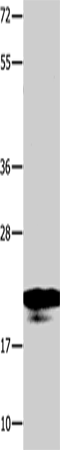 Western Blot analysis of A549 cell  using NME1 Polyclonal Antibody at dilution of 1:950