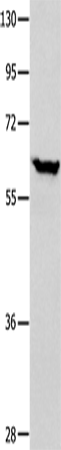 Western Blot analysis of Human seminoma tissue using DNAJC7 Polyclonal Antibody at dilution of 1:400