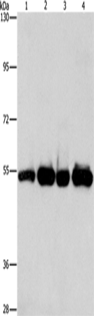 Western Blot analysis of Human bladder carcinoma tissue and A172 cell, Human fetal brain tissue and hela cell using PDE4D Polyclonal Antibody at dilution of 1:500