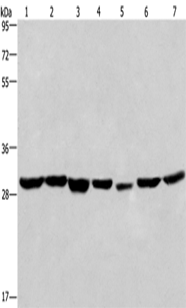 Western Blot analysis of 293T and A549 cell,Human liver cancer tissue and PC3 cell ,Human placenta tissue,hela cell and Mouse heart tissue using PHB Polyclonal Antibody at dilution of 1:350
