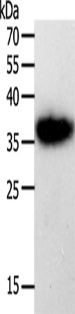 Western Blot analysis of A549 cell using PLAUR Polyclonal Antibody at dilution of 1:450