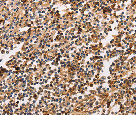 Immunohistochemistry of paraffin-embedded Human tonsil using PPP1CB Polyclonal Antibody at dilution of 1:30