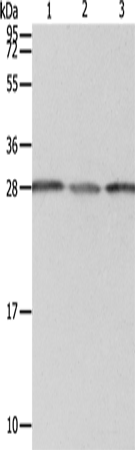 Western Blot analysis of A549 cell, Human liver cancer and fetal kidney tissue using PSMD9 Polyclonal Antibody at dilution of 1:800