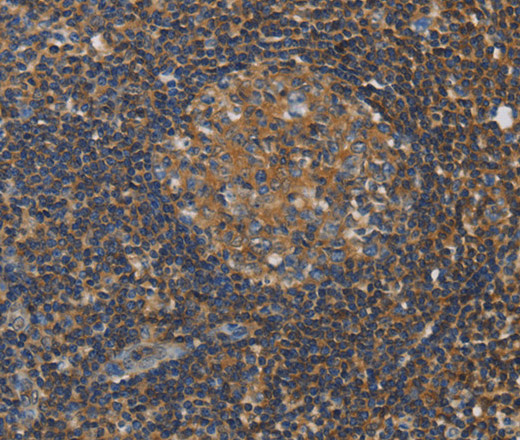 Immunohistochemistry of paraffin-embedded Human tonsil tissue using RAD54L2 Polyclonal Antibody at dilution 1:40