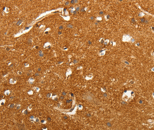 Immunohistochemistry of paraffin-embedded Human brain tissue using SLC4A4 Polyclonal Antibody at dilution 1:50