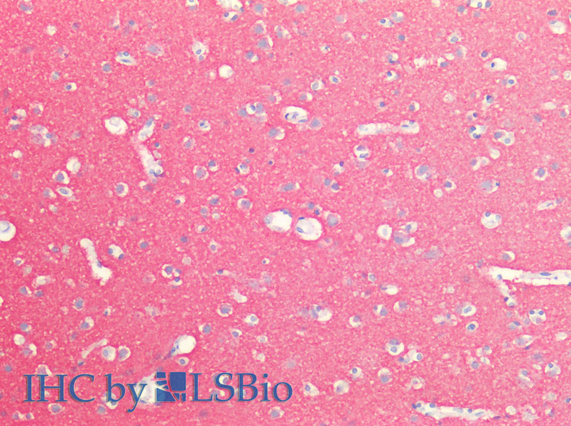 Immunohistochemistry of paraffin-embedded Human Brain using SNAP25 Polyclonal Antibody at dilution of 1:100.