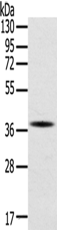 Western Blot analysis of A375 cell using SPARC Polyclonal Antibody at dilution of 1:400