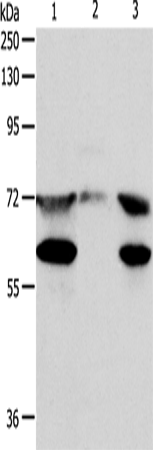 Western Blot analysis of Hela cell, Mouse testis tissue and Jurkat cell using CCDC99 Polyclonal Antibody at dilution of 1:400