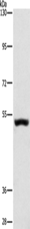 Western Blot analysis of Mouse kidney tissue using SYT17 Polyclonal Antibody at dilution of 1:650