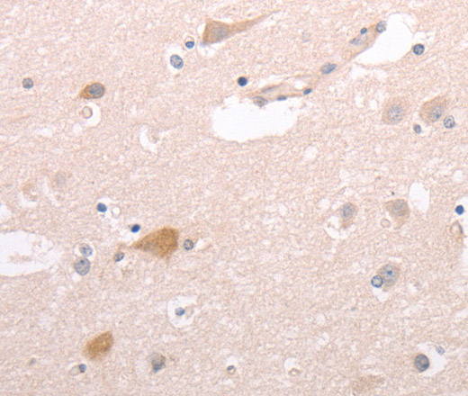 Immunohistochemistry of paraffin-embedded Human brain tissue using CIDEB Polyclonal Antibody at dilution 1:50