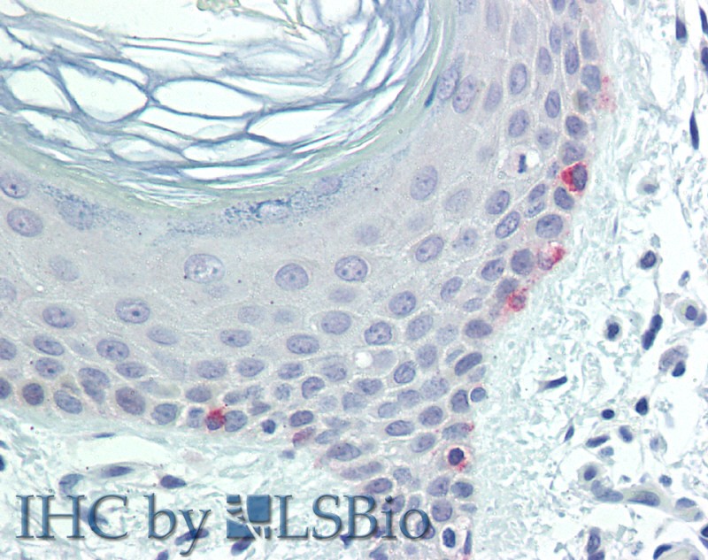 Immunohistochemistry of paraffin-embedded Skin tissue using TYR Polyclonal Antibody at dilution of 1:100 .