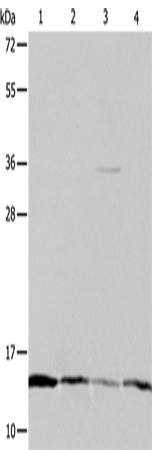 Western Blot analysis of Hela, Jurkat, MCF7 and A431 cell using ATPIF1 Polyclonal Antibody at dilution of 1:1200