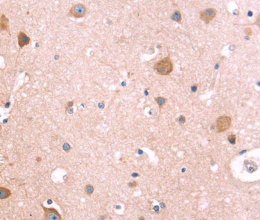 Immunohistochemistry of paraffin-embedded Human brain using ST2 Polyclonal Antibody at dilution of 1:40