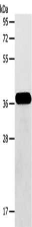 Western Blot analysis of Human fetal brain tissue using AASDHPPT Polyclonal Antibody at dilution of 1:600