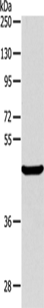 Western Blot analysis of Mouse pancreas tissue using ALKBH1 Polyclonal Antibody at dilution of 1:400