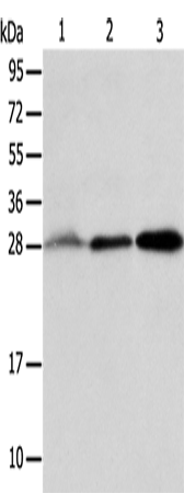 Western Blot analysis of Human fetal liver and seminoma tissue, RAW264.7 cell using ALKBH2 Polyclonal Antibody at dilution of 1:800