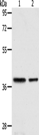 Western Blot analysis of Human fetal kidney and fetal muscle tissue using CNN3 Polyclonal Antibody at dilution of 1:400