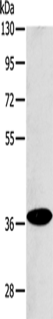 Western Blot analysis of Raji cell using ACMSD Polyclonal Antibody at dilution of 1:400