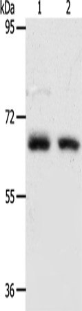 Western Blot analysis of Human fetal kidney and fetal lung tissue using ACOT11 Polyclonal Antibody at dilution of 1:450