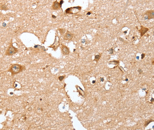 Immunohistochemistry of paraffin-embedded Human brain using CAPG Polyclonal Antibody at dilution of 1:40