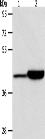Western Blot analysis of Jurkat and RAW264.7 cell using CAPG Polyclonal Antibody at dilution of 1:950