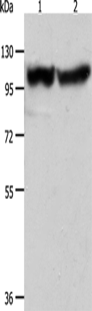 Western Blot analysis of Human fetal muscle tissue and hela cell using ACTN3 Polyclonal Antibody at dilution of 1:400