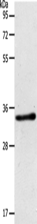 Western Blot analysis of Mouse kidney tissue using ACY3 Polyclonal Antibody at dilution of 1:500