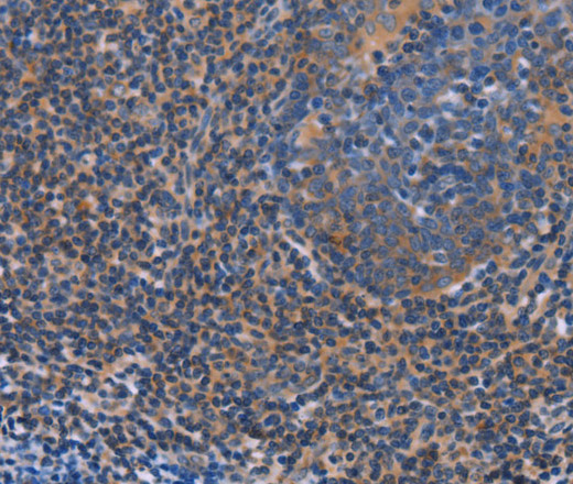 Immunohistochemistry of paraffin-embedded Human tonsil using AGFG1 Polyclonal Antibody at dilution of 1:60