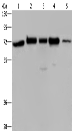 Western Blot analysis of A172, Hela and 293T cell, K562 cell and Human testis tissue using AGFG1 Polyclonal Antibody at dilution of 1:727