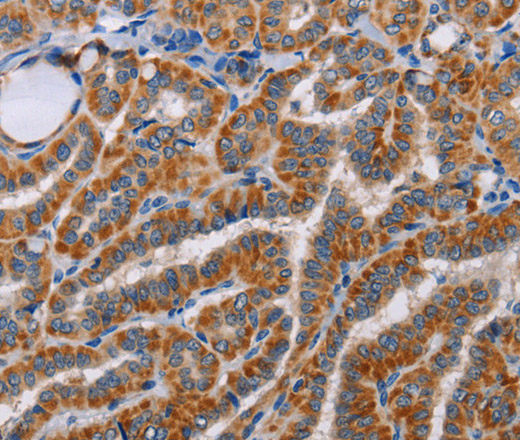 Immunohistochemistry of paraffin-embedded Human brain tissue using ALG9 Polyclonal Antibody at dilution 1:60