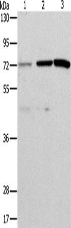 Western Blot analysis of Hela and SKOV3 cell, Mouse liver tissue using ALS2CR11 Polyclonal Antibody at dilution of 1:500