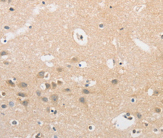 Immunohistochemistry of paraffin-embedded Human brain  tissue using APLF Polyclonal Antibody at dilution 1:40