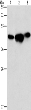 Western Blot analysis of 293T, PC3 and NIH/3T3 cell using ARFGAP1 Polyclonal Antibody at dilution of 1:850