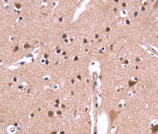 Immunohistochemistry of paraffin-embedded Human brain  tissue using ARC Polyclonal Antibody at dilution 1:50