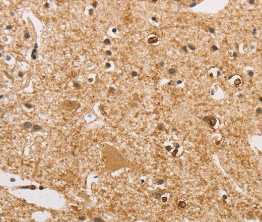 Immunohistochemistry of paraffin-embedded Human brain  using ARHGEF5 Polyclonal Antibody at dilution of 1:50