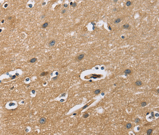 Immunohistochemistry of paraffin-embedded Human brain  tissue using FLT3 Polyclonal Antibody at dilution 1:50