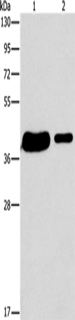 Western Blot analysis of 293T and A431 cell using SAE1 Polyclonal Antibody at dilution of 1:400