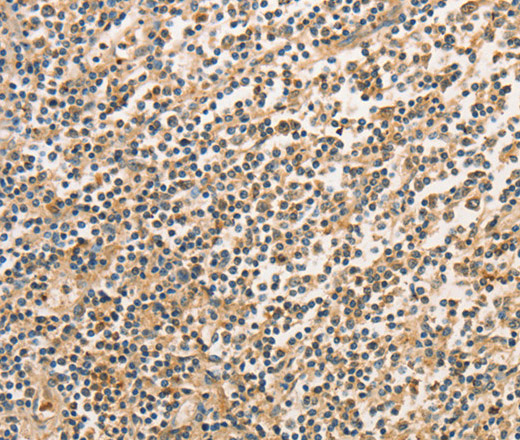 Immunohistochemistry of paraffin-embedded Human tonsil tissue using BCL2L14 Polyclonal Antibody at dilution 1:40