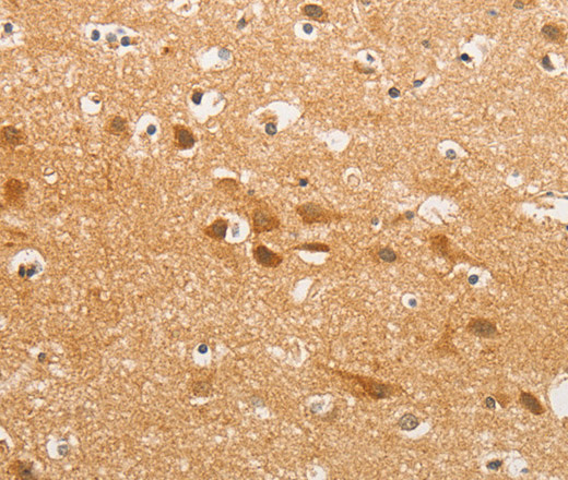 Immunohistochemistry of paraffin-embedded Human brain using K-Cadherin Polyclonal Antibody at dilution of 1:50