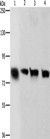 Western Blot analysis of Hela and A549 cell, Human liver cancer tissue and HT-29 cell using K-Cadherin Polyclonal Antibody at dilution of 1:500