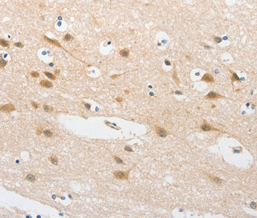 Immunohistochemistry of paraffin-embedded Human brain  tissue using TLR5 Polyclonal Antibody at dilution 1:30